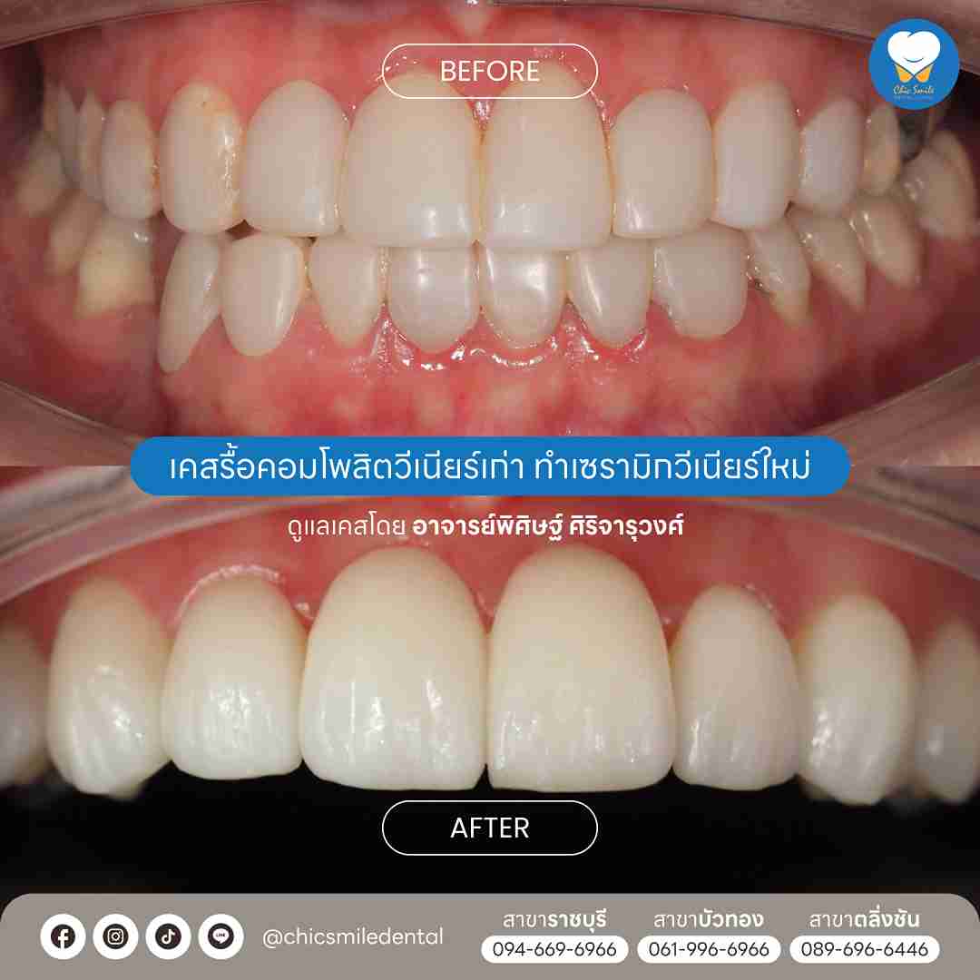 Chic smile case01_11zon